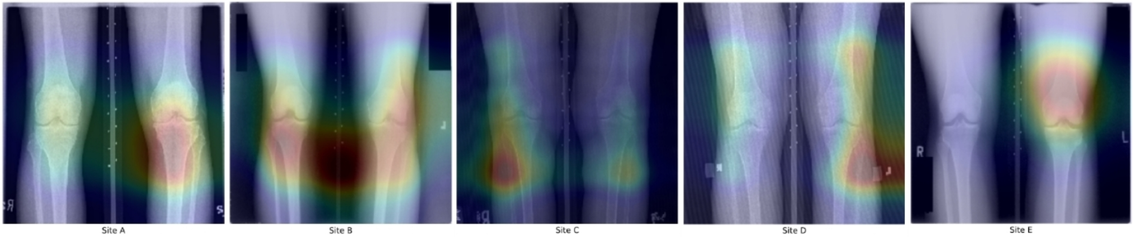 AI Thought X-rays of Your Knees Show if You Drink Beer (They Don't)